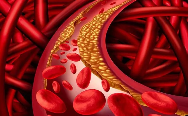 Một số nghiên cứu đã chỉ ra rằng các hoạt chất có trong tinh dầu thông đỏ có thể có khả năng giảm mức cholesterol và triglyceride trong máu, hai yếu tố quan trọng liên quan đến rối loạn mỡ máu.